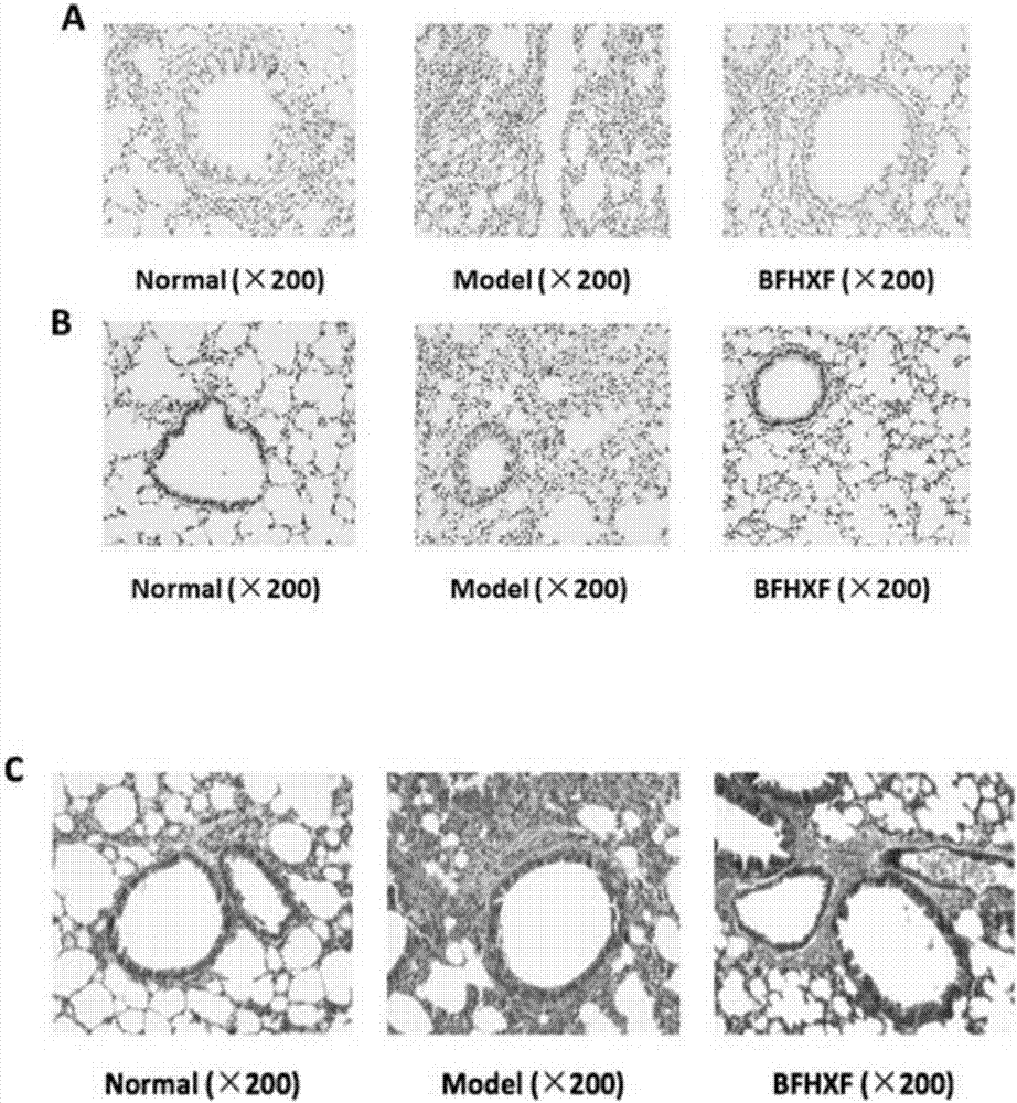 Use of Bufei Huoxue Capsules for the treatment or prevention of lung injury caused by PM2.5