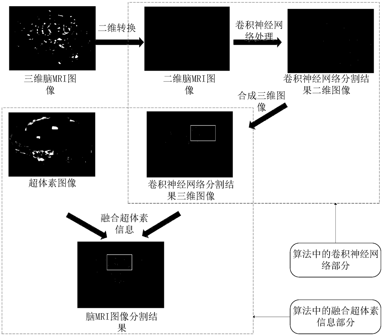 A magnetic resonance image segmentation method combining global and local information