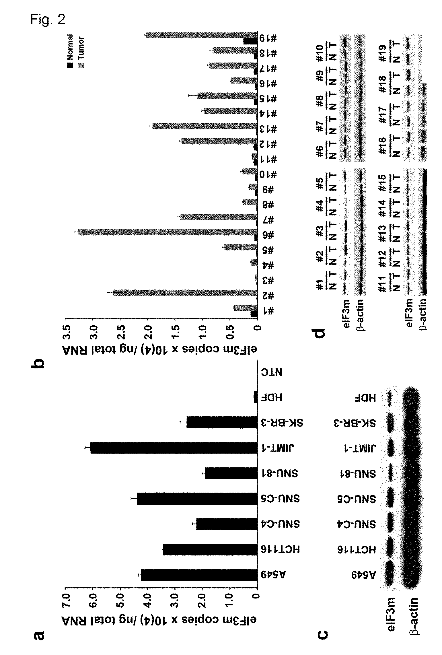 Use of eIF3m for the diagnosis and treatment of cancer