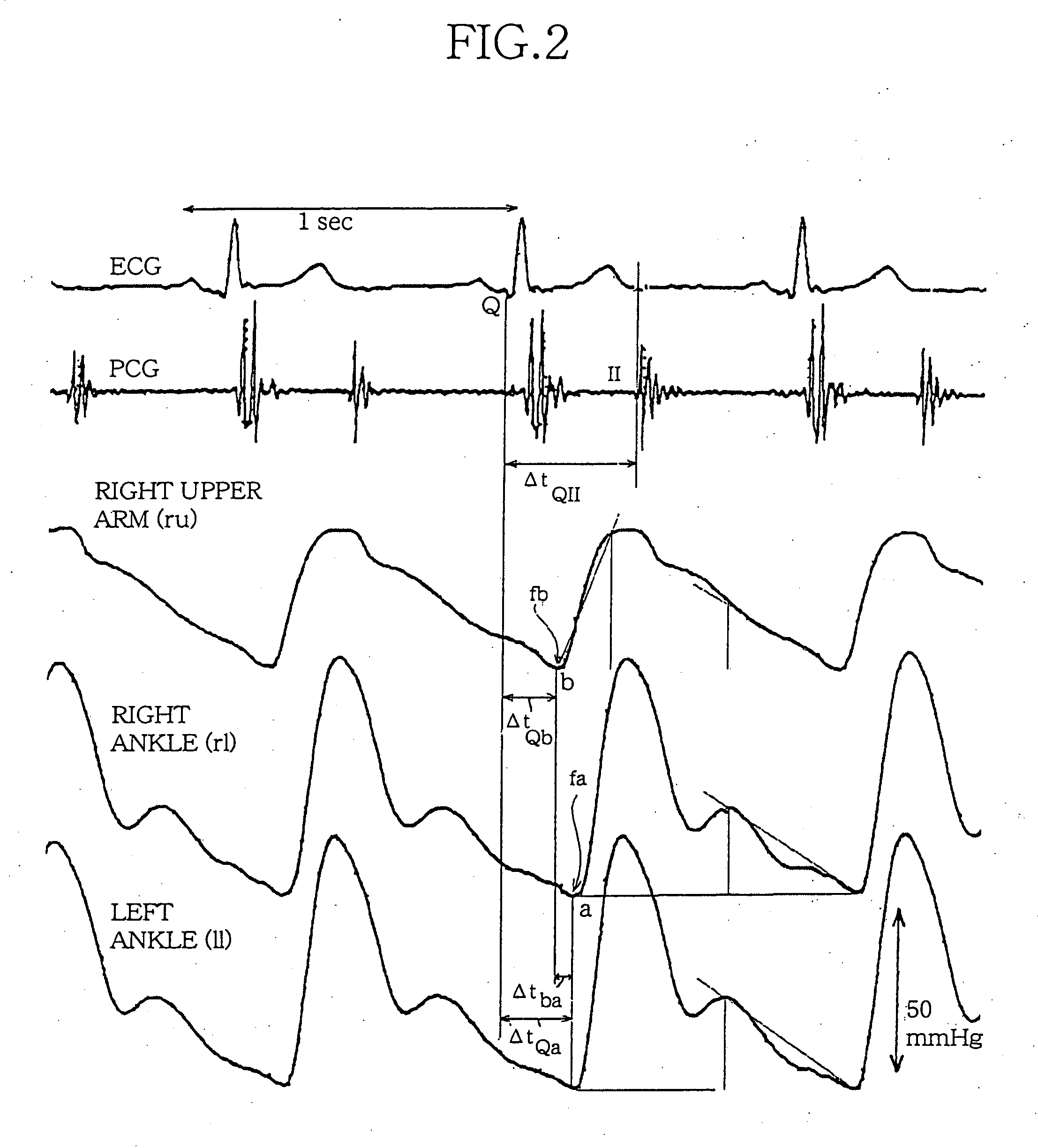 Pulse wave analyzing method, pulse wave analyzing software, and so forth