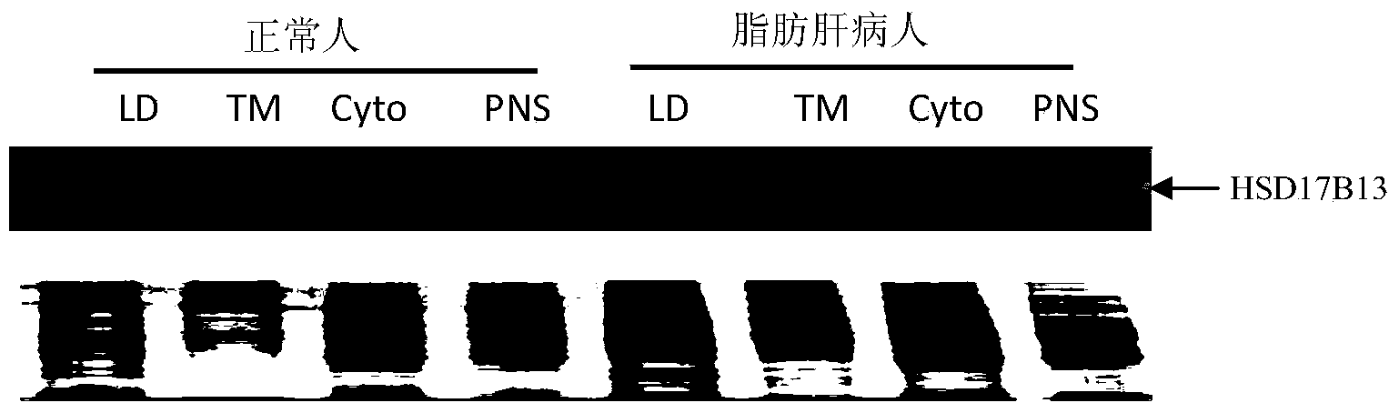 Novel application of inhibitor for protein HSD17B13 or coding genes thereof