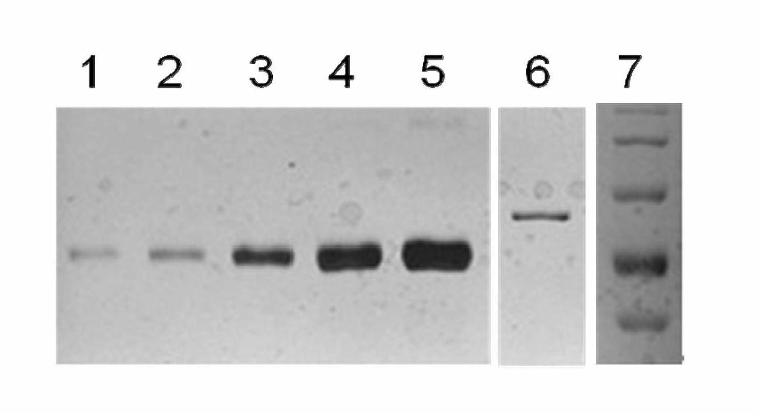 Diagnostic kit and application of BFAR (bifunctional apoptosis regulator) in preparation of gastric cancer early diagnostic reagent