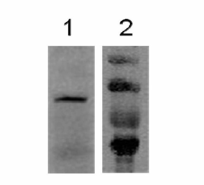 Diagnostic kit and application of BFAR (bifunctional apoptosis regulator) in preparation of gastric cancer early diagnostic reagent