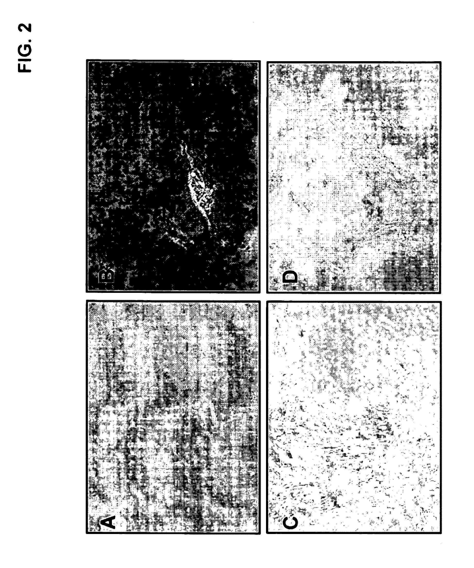 Method for treating pancreatitis with mesenchymal stem cells