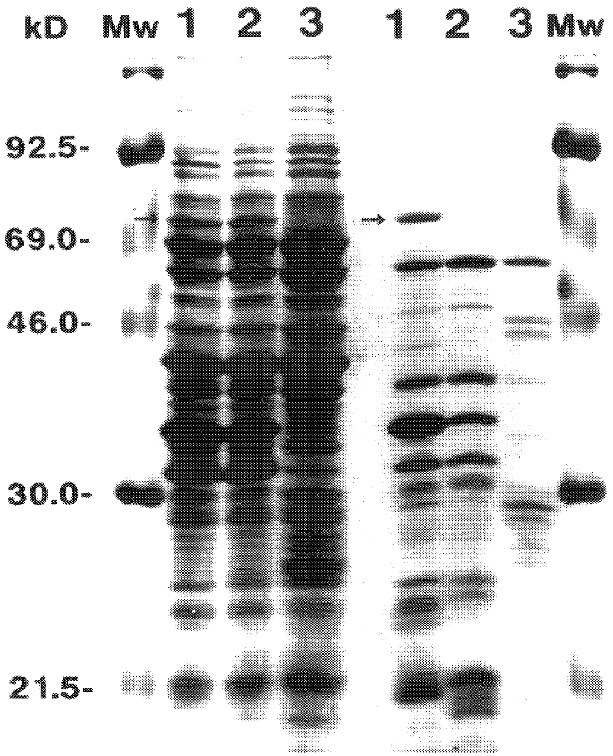 66 kDa antigen from Borrelia