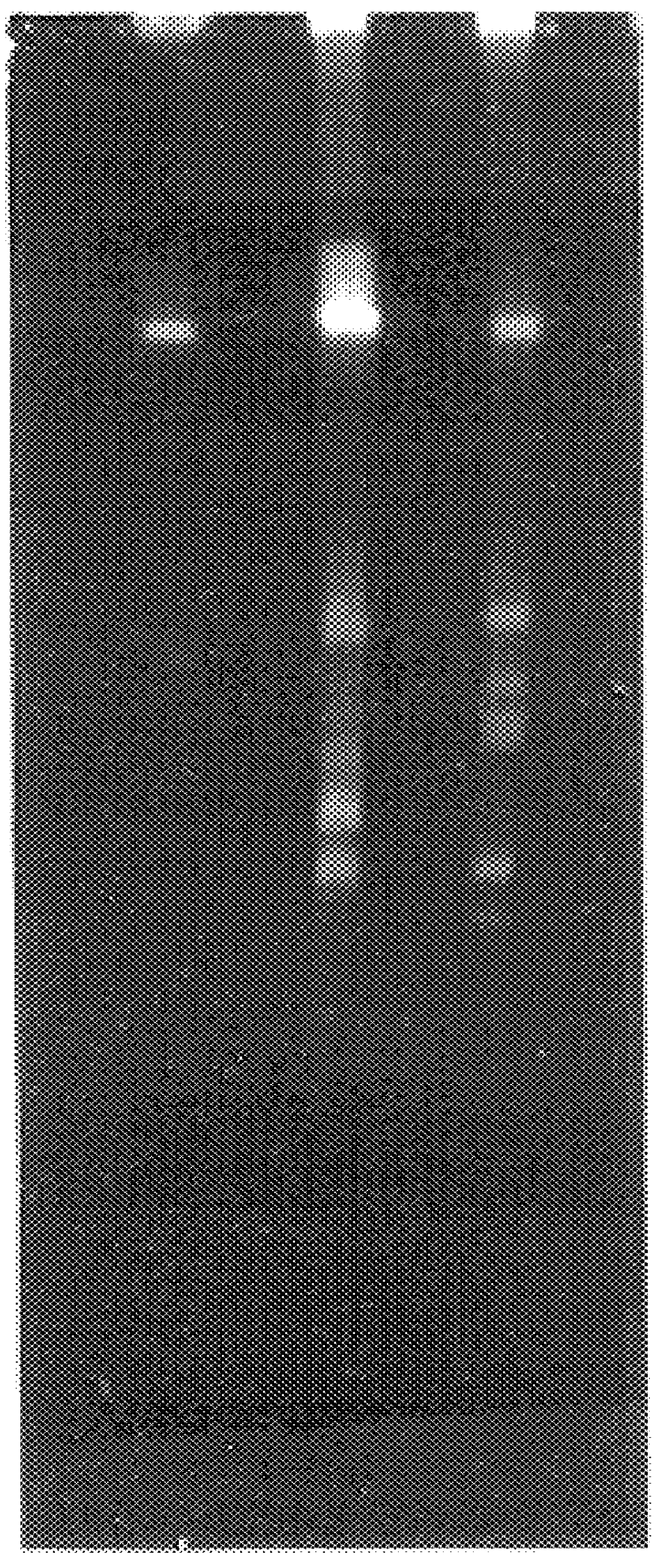 66 kDa antigen from Borrelia