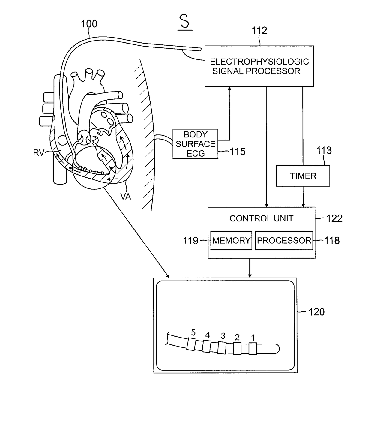 System and method for visualizing electrophysiology data