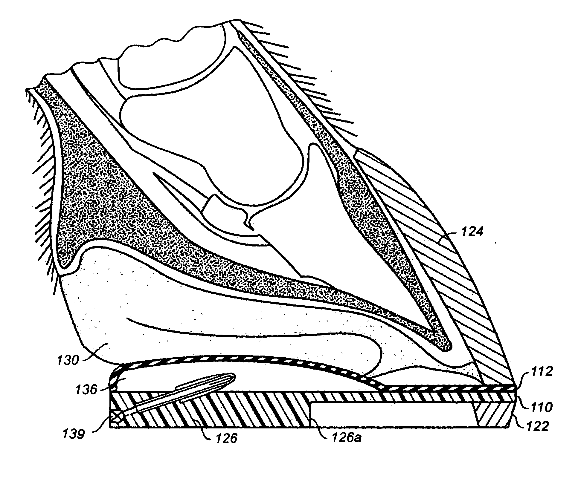 Inflatable horseshoe support pad