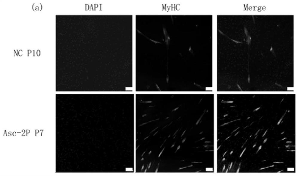 Improved culture medium for in-vitro amplification culture of cultured meat seed cells and application thereof