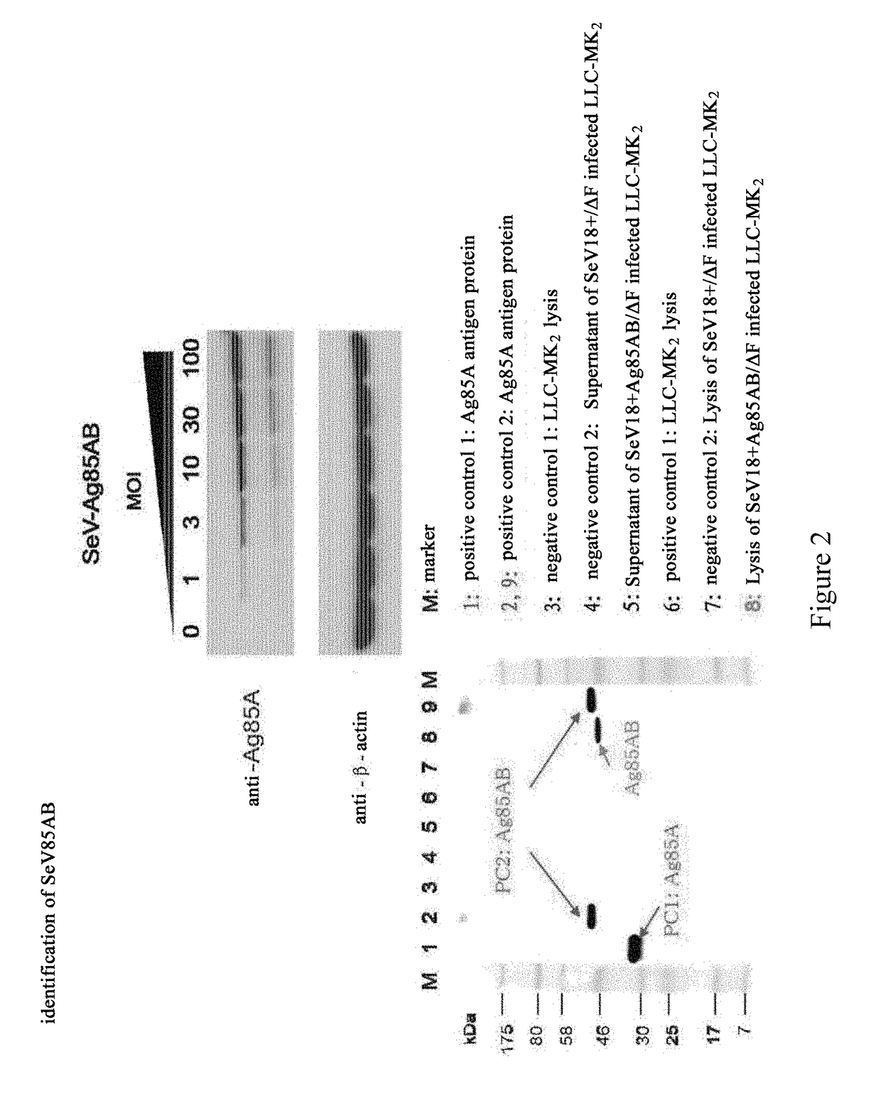 Anti-mycobacterium tuberculosis vaccine using sendai virus as vector