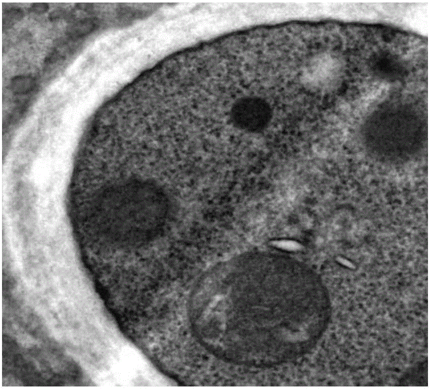 Application of cinnamaldehyde in preparation of drugs for targeted therapy of drug-resistant aspergillus infection