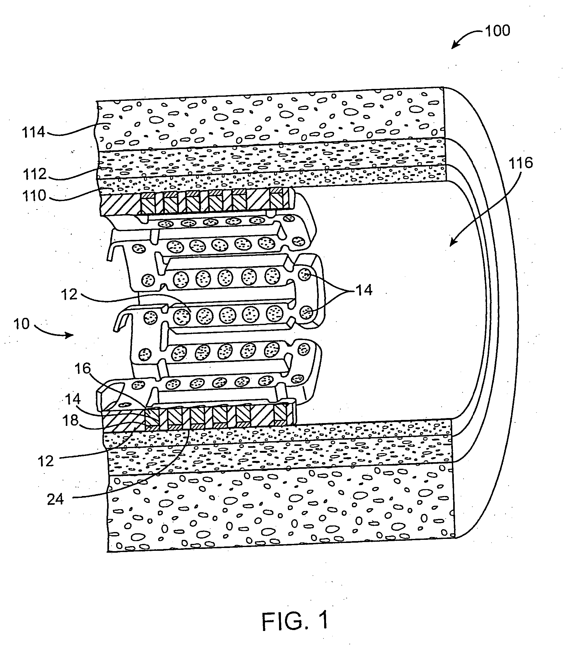 Method and apparatus for reducing tissue damage after ischemic injury