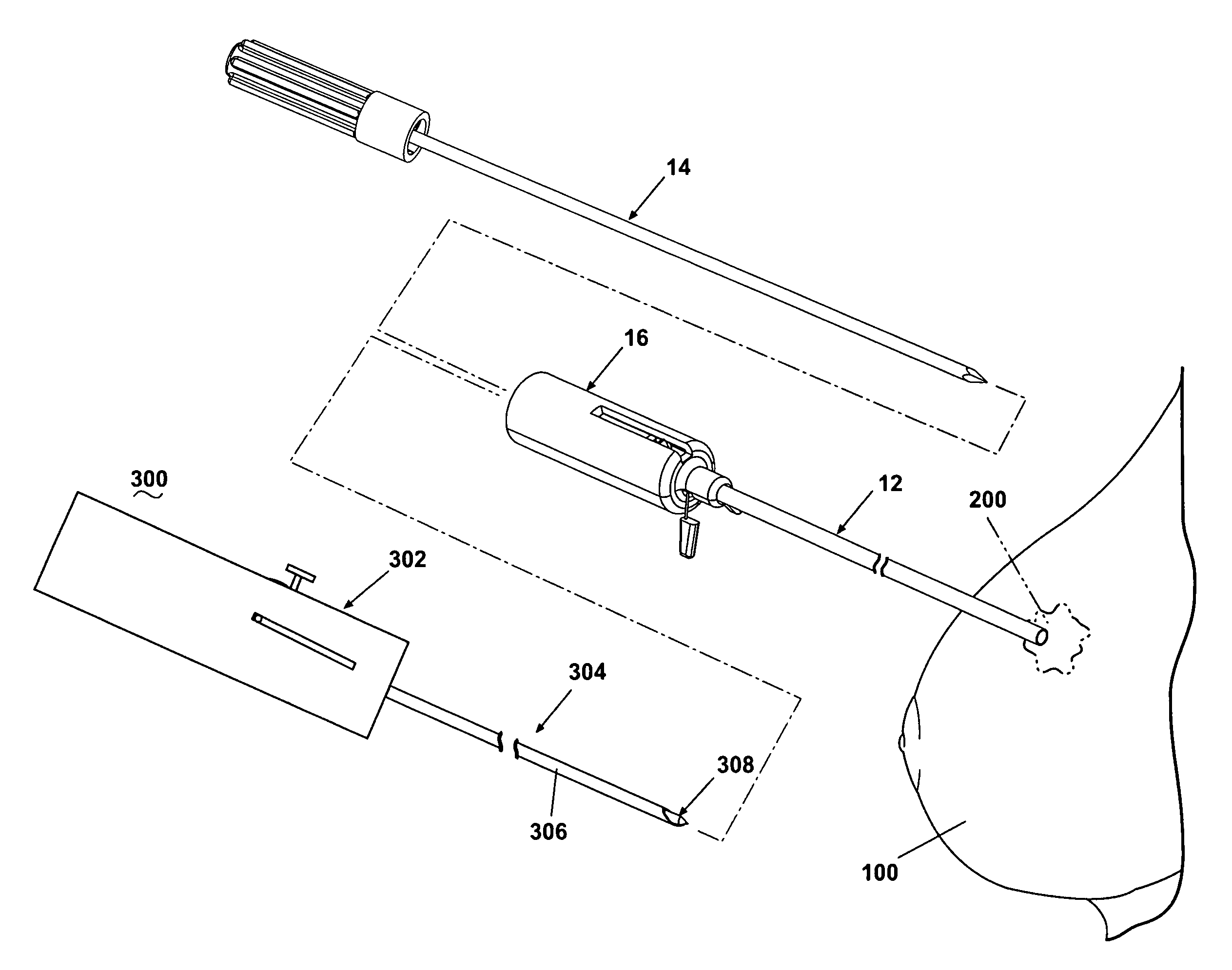 Coaxial needle assembly