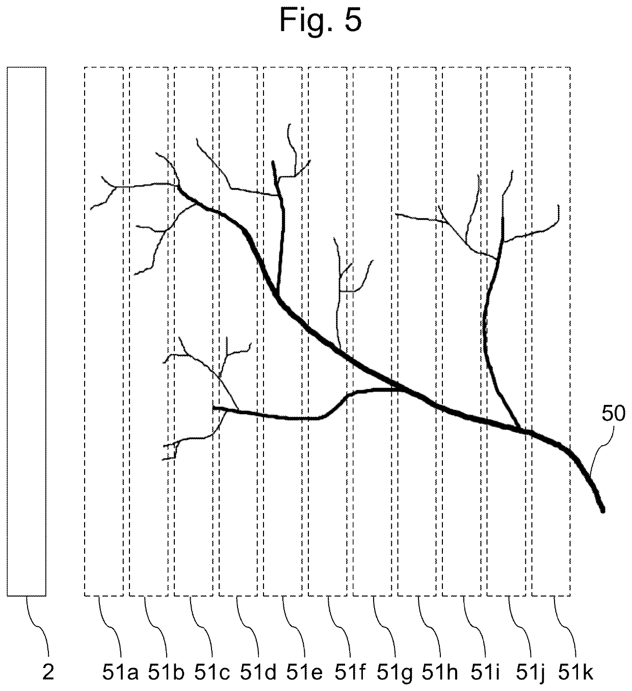 Ultrasound blood-flow monitoring