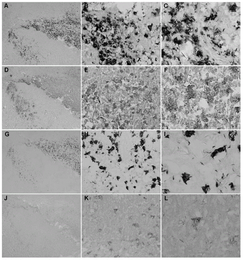 Kit and staining method for doubly staining mycobacterium tuberculosis and antigen of mycobacterium tuberculosis