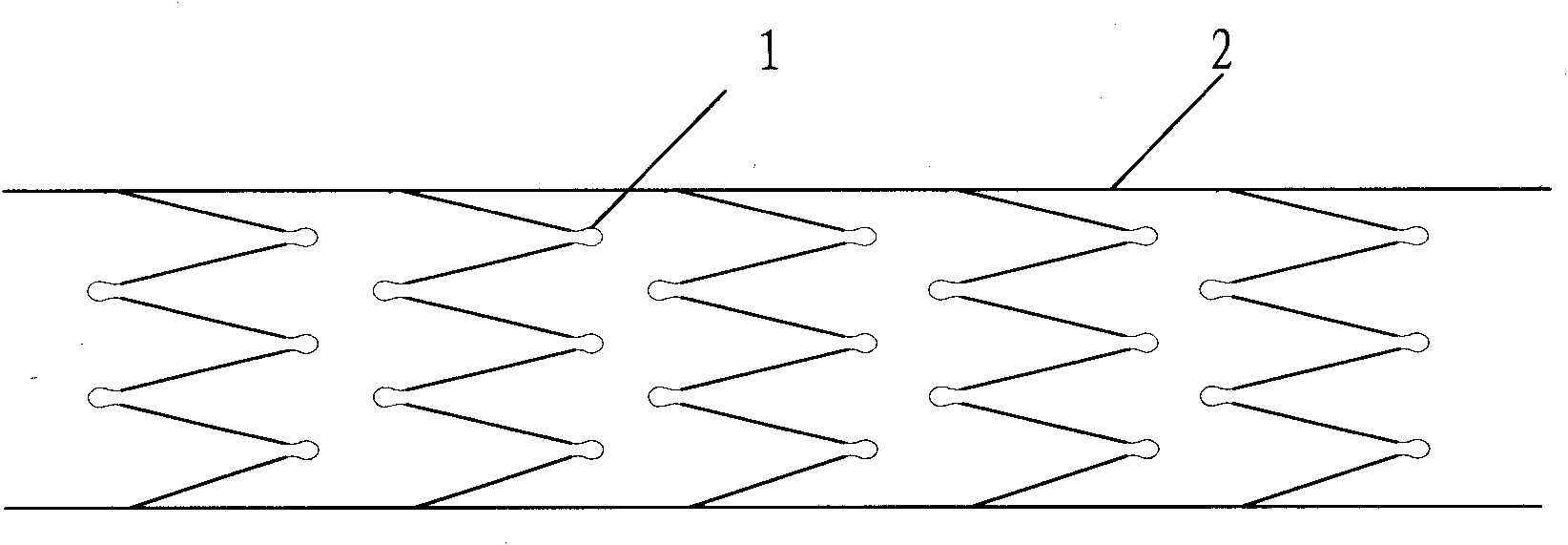 Blood vessel bracket prosthesis