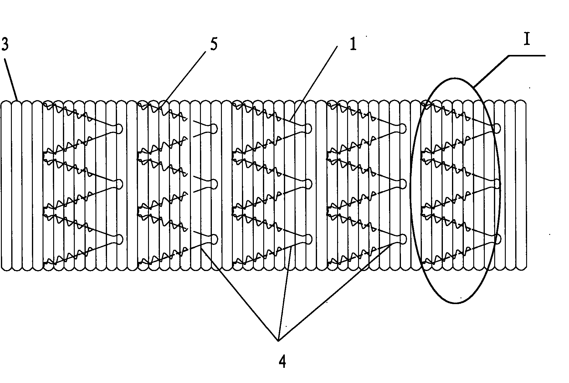 Blood vessel bracket prosthesis