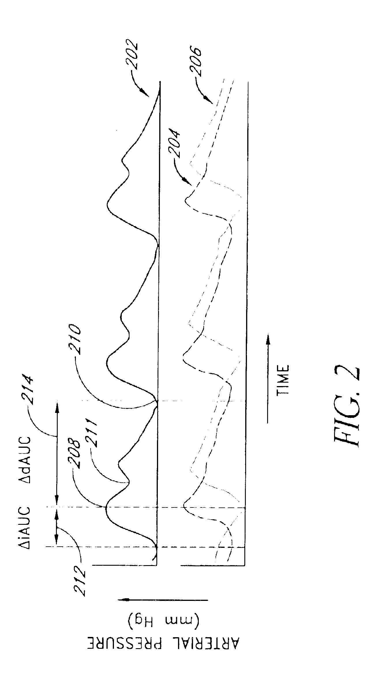 Method and apparatus for measuring pulsus paradoxus