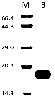 Vitellogenin peptide fragment tfVWD used for binding to tetrodotoxin, nucleotide sequence of vitellogenin peptide fragment tfVWD, polyclonal antibody of vitellogenin peptide fragment tfVWD and preparation method for vitellogenin peptide fragment tfVWD