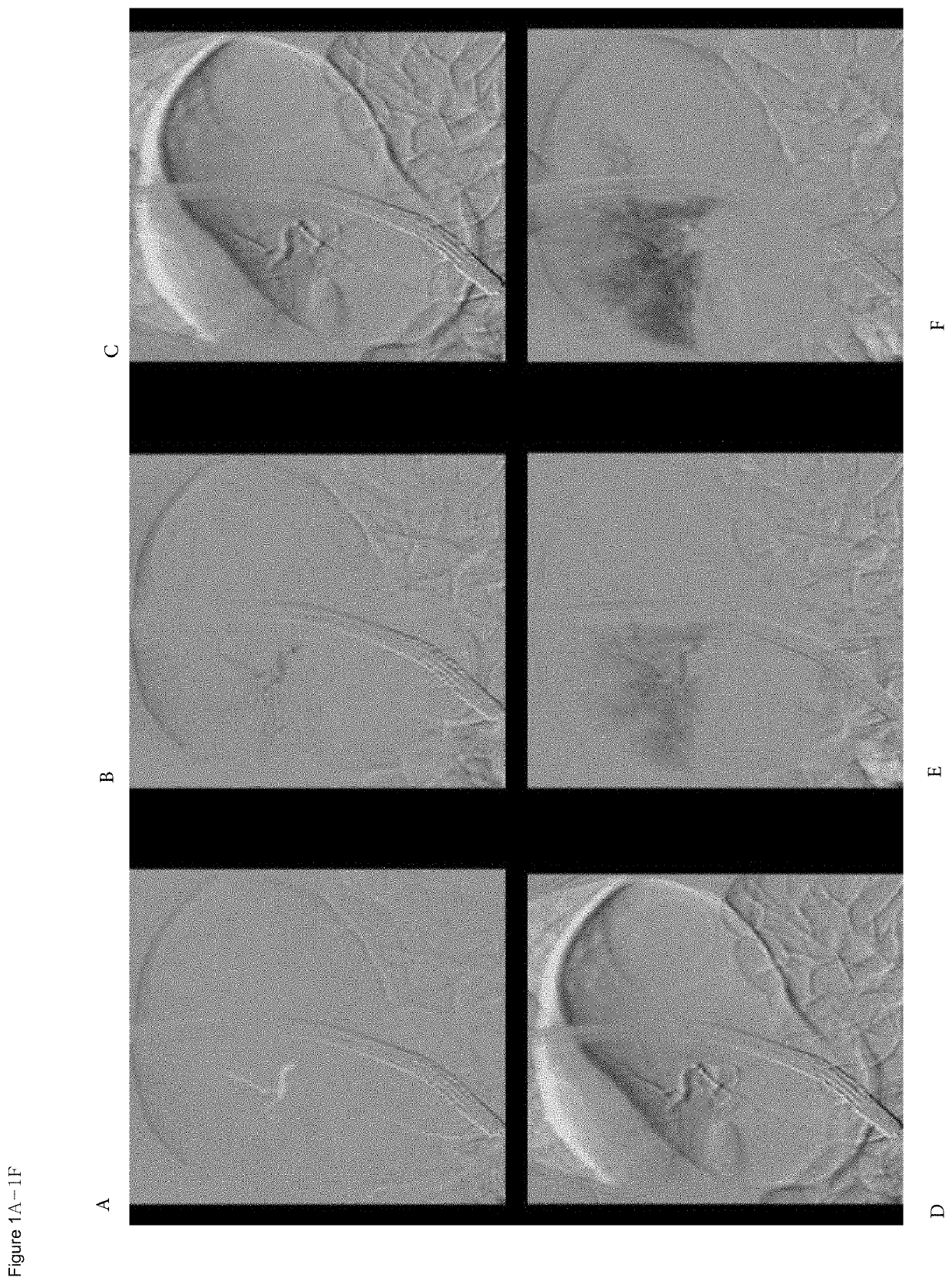 Organ directed gene delivery