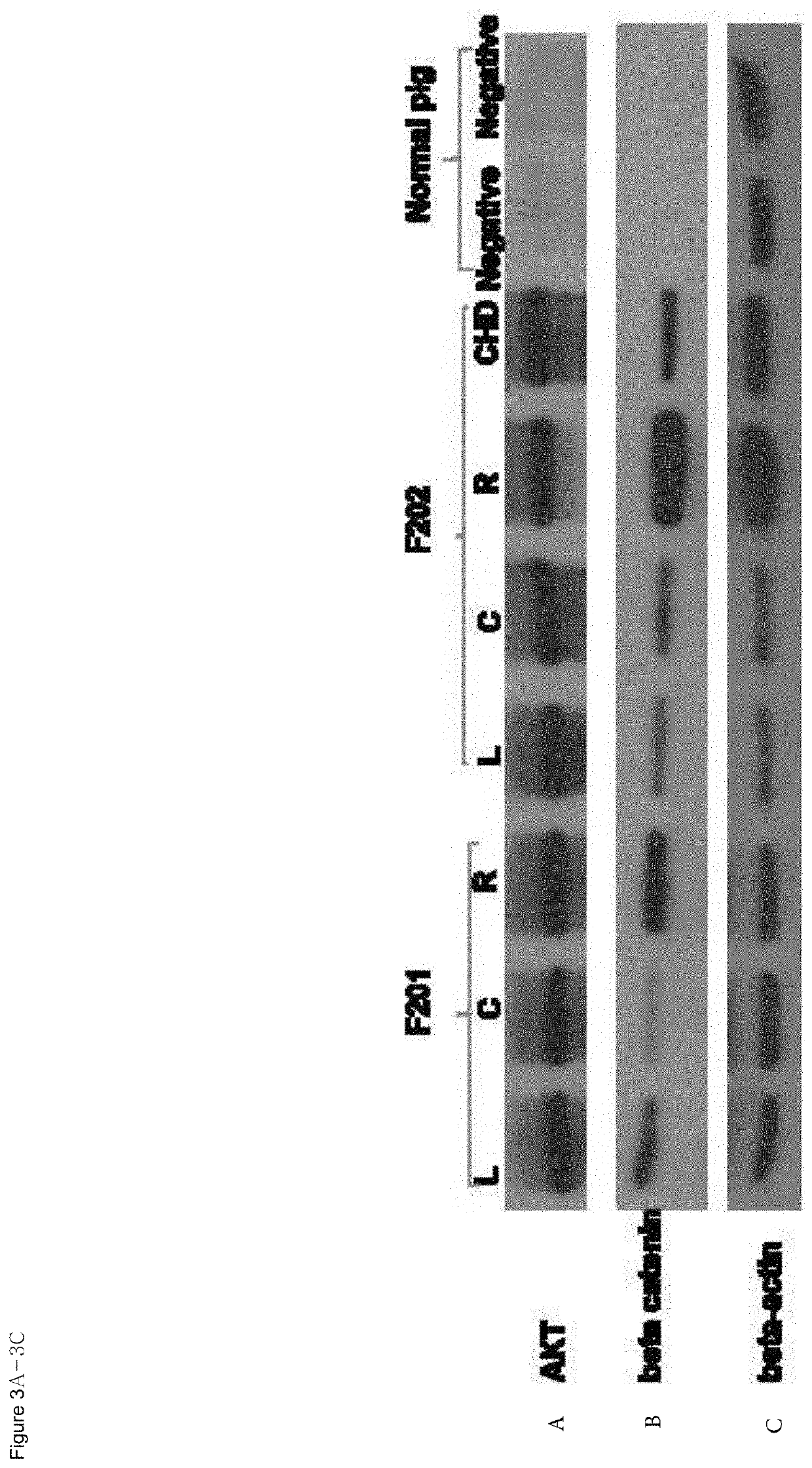 Organ directed gene delivery