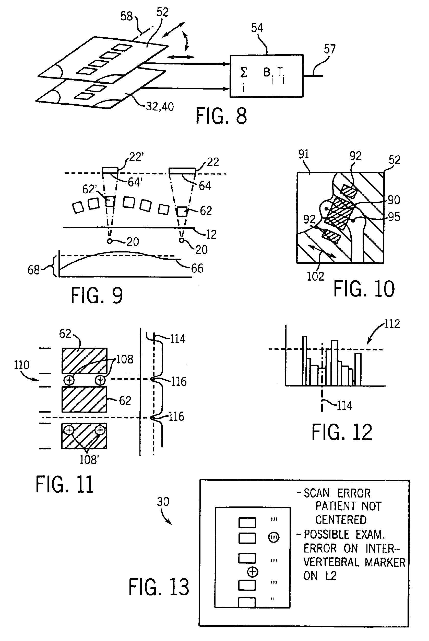 Computer-assisted bone densitometer