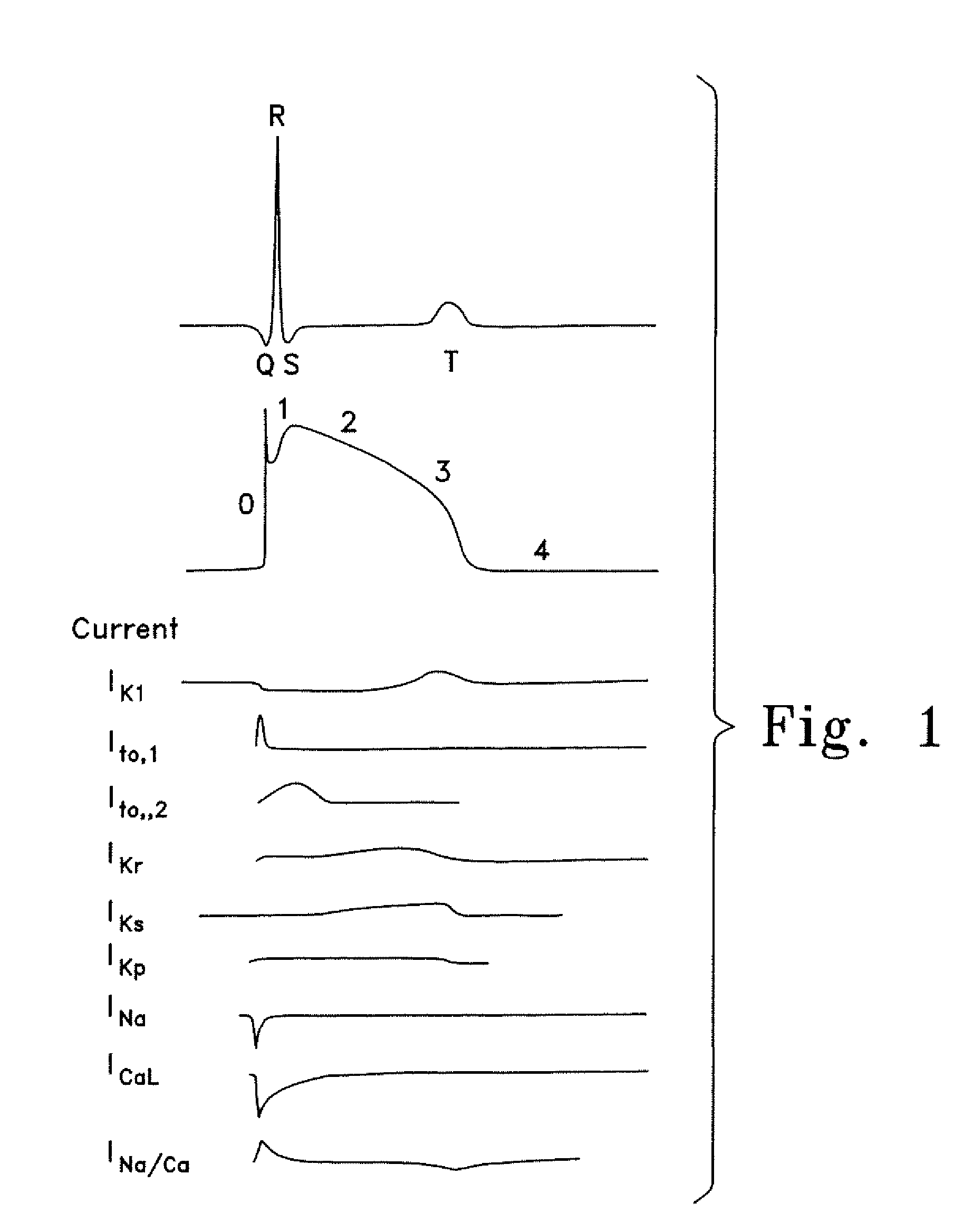 Method of treating arrhythmias