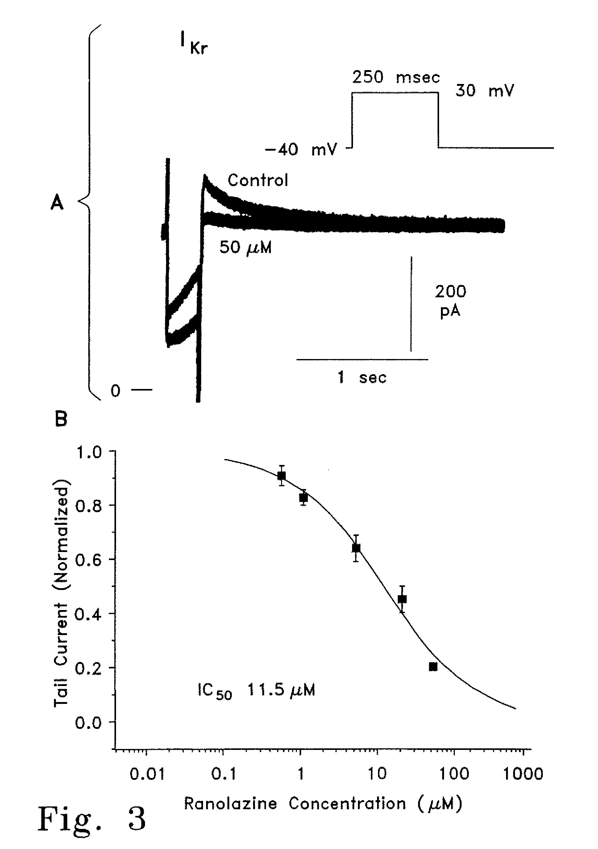 Method of treating arrhythmias