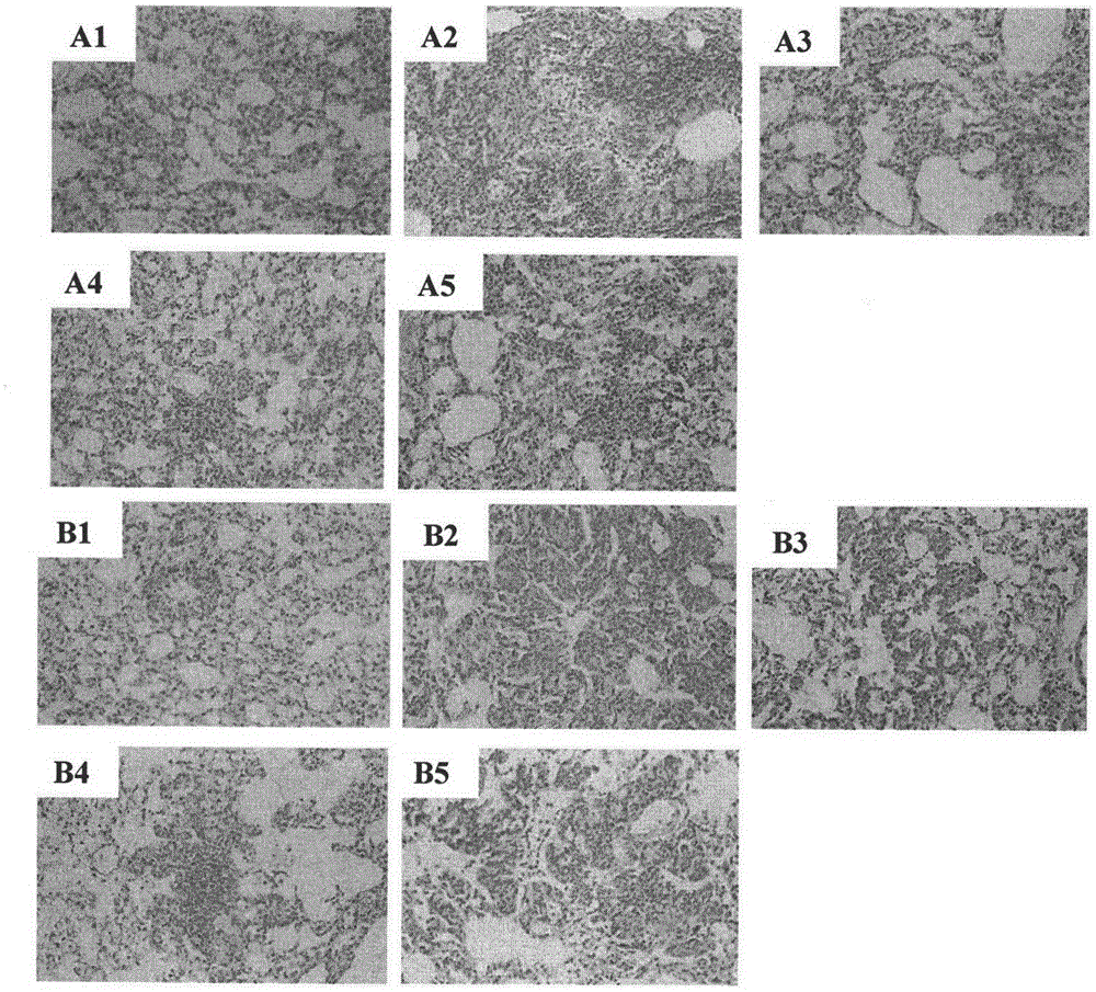 Application of an azazulene alkaloid in the preparation of drugs for preventing or treating pulmonary fibrosis