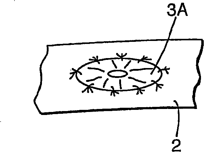 Abdominal reinforcement device