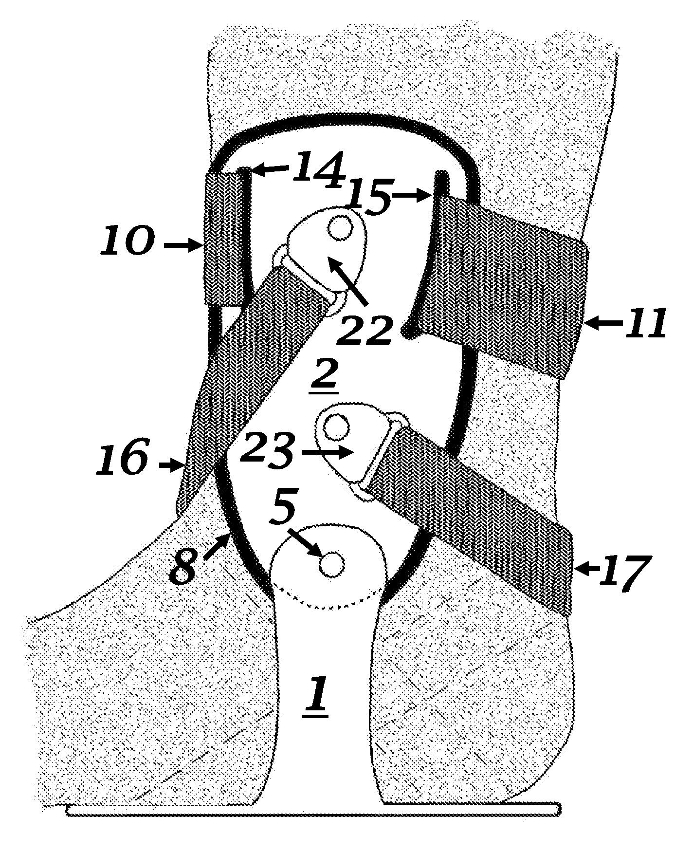 Ankle Brace Design for Optimal Fit to Either Right or Left Extremity Contours