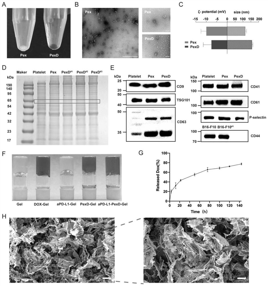 Fibrin gel containing adriamycin-entrapped platelet exosome and PD-L1 monoclonal antibody as well as preparation method and application of fibrin gel