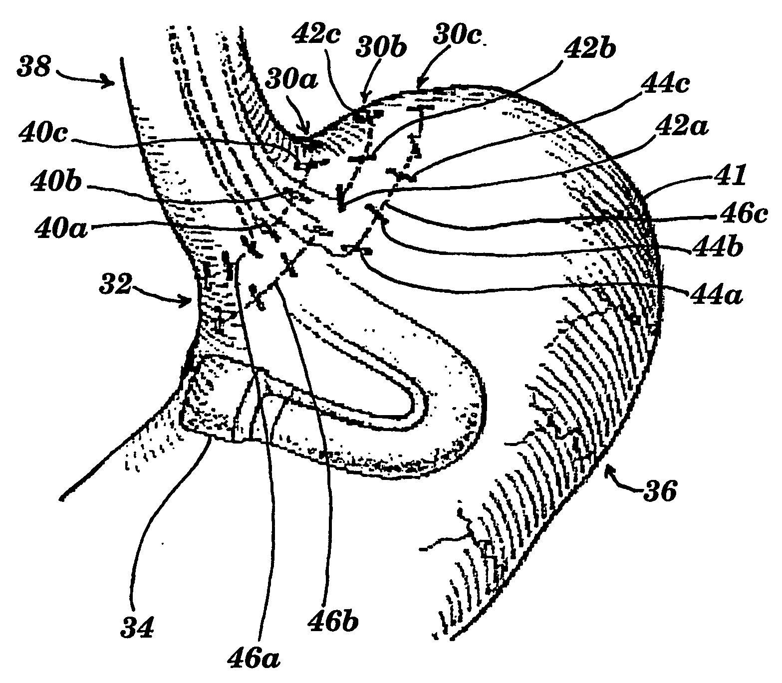 Suturing Devices and Methods