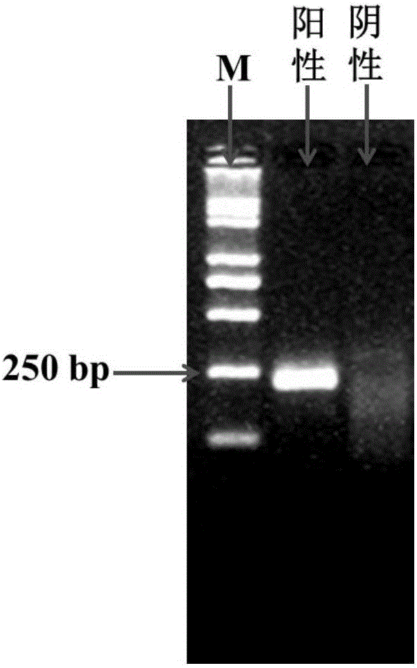 Method for detecting blood fluke DNA