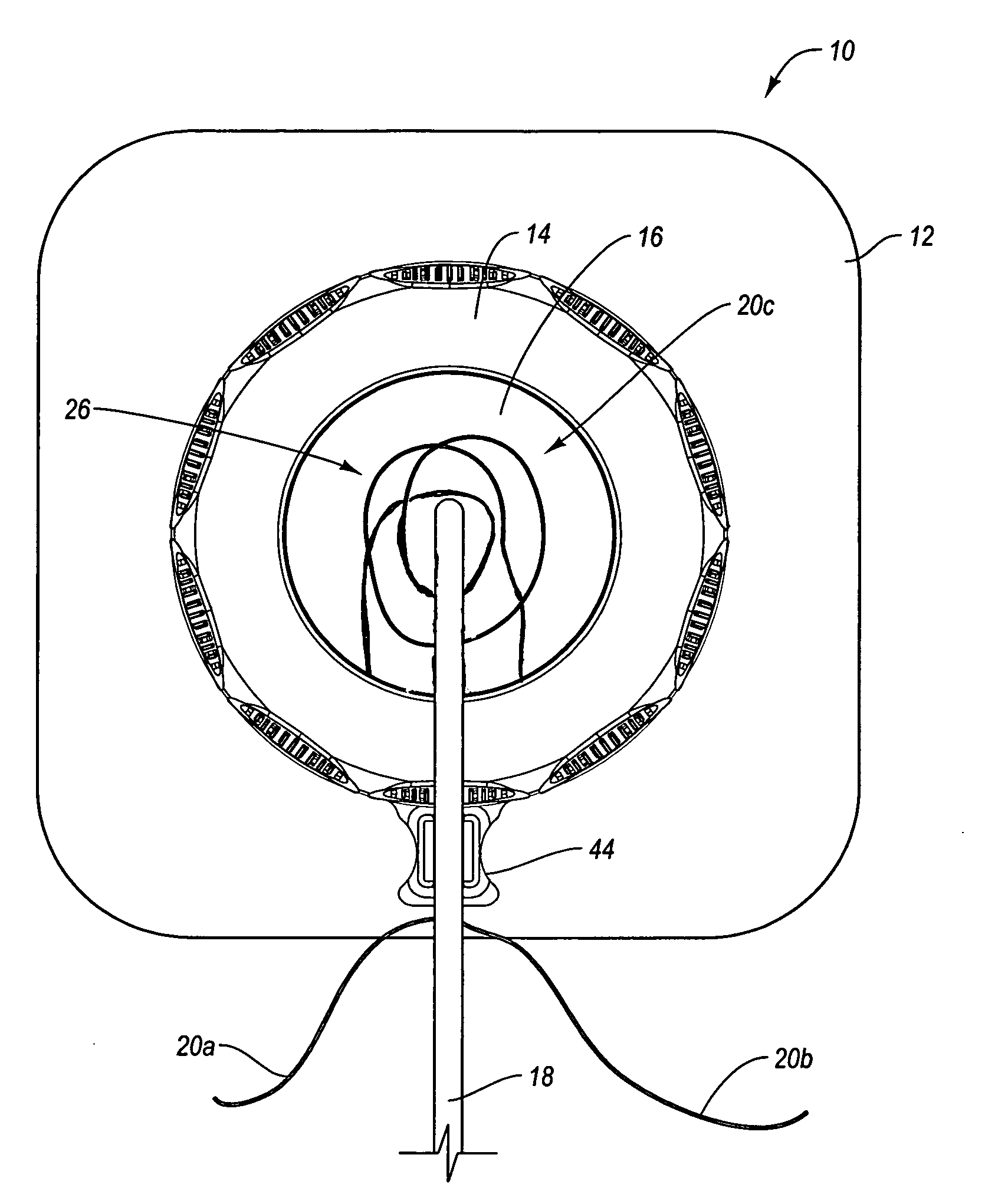 Self suturing anchor device