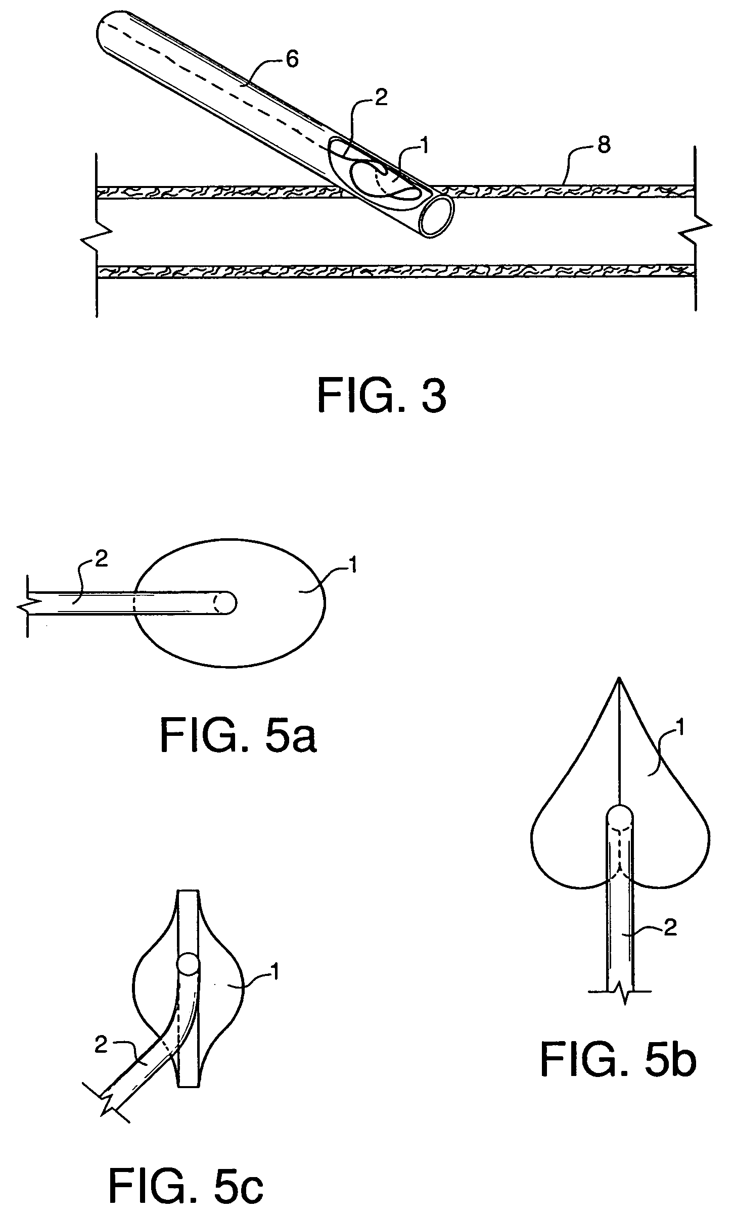 Sealing device