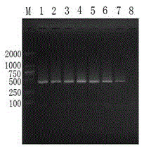 Porcine circovirus type 2 lamp diagnostic kit