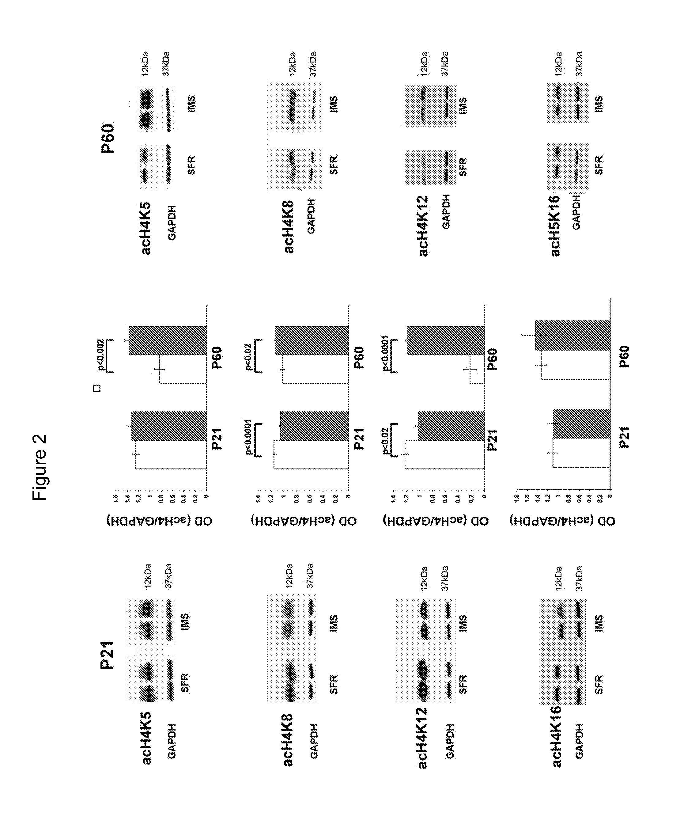 Compositions and methods for treating mood disorders