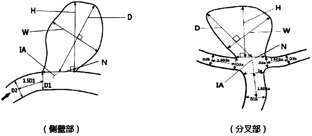 A method and system for measuring morphological parameters of an image of an intracranial aneurysm