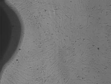 Method for primary culture of human umbilical vessel smooth muscle cells