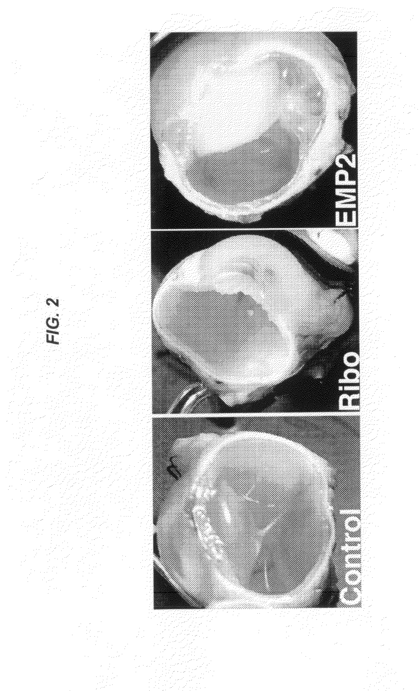 Epithelial membrane protein-2 (EMP2) and proliferative vitroretinopathy (PVR)