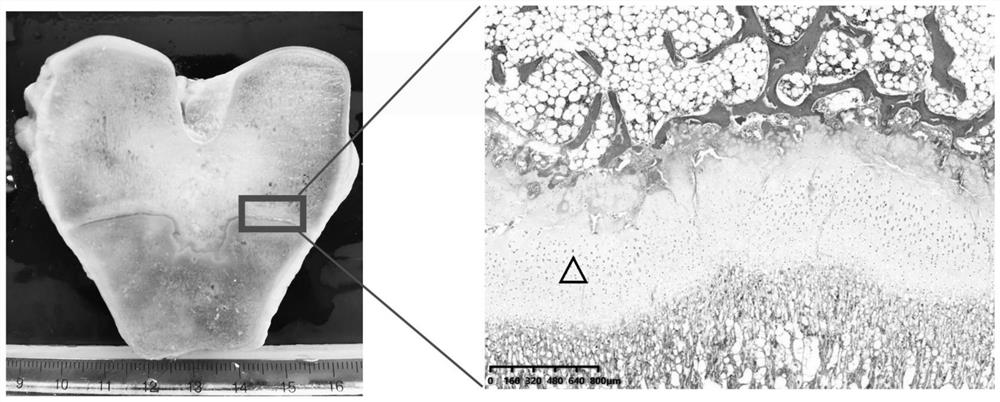 Preparation method of natural tissue-derived epiphyseal cartilage combined bone acellular material