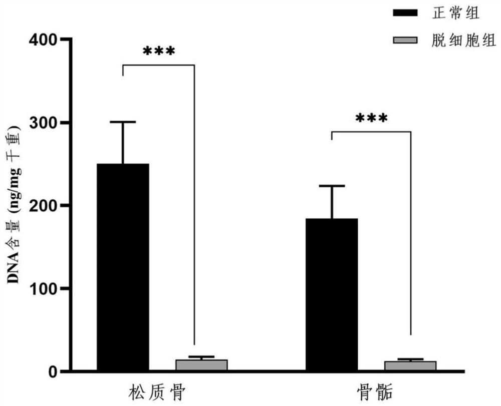 Preparation method of natural tissue-derived epiphyseal cartilage combined bone acellular material