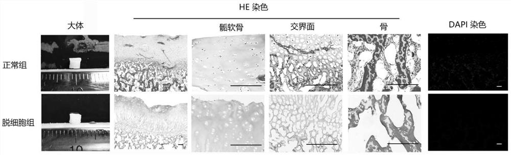 Preparation method of natural tissue-derived epiphyseal cartilage combined bone acellular material