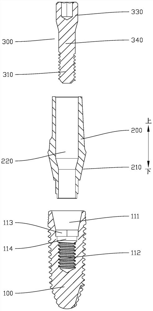 Double-sided fusion connected dental implant assembly