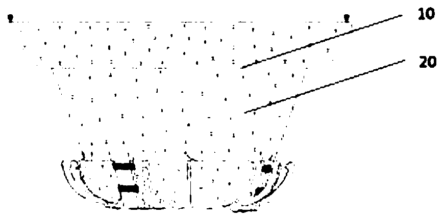 Telescopic movable stent and interventional heart prosthesis valve