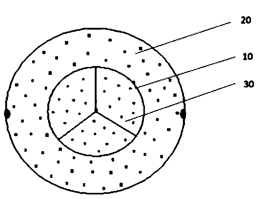 Telescopic movable stent and interventional heart prosthesis valve