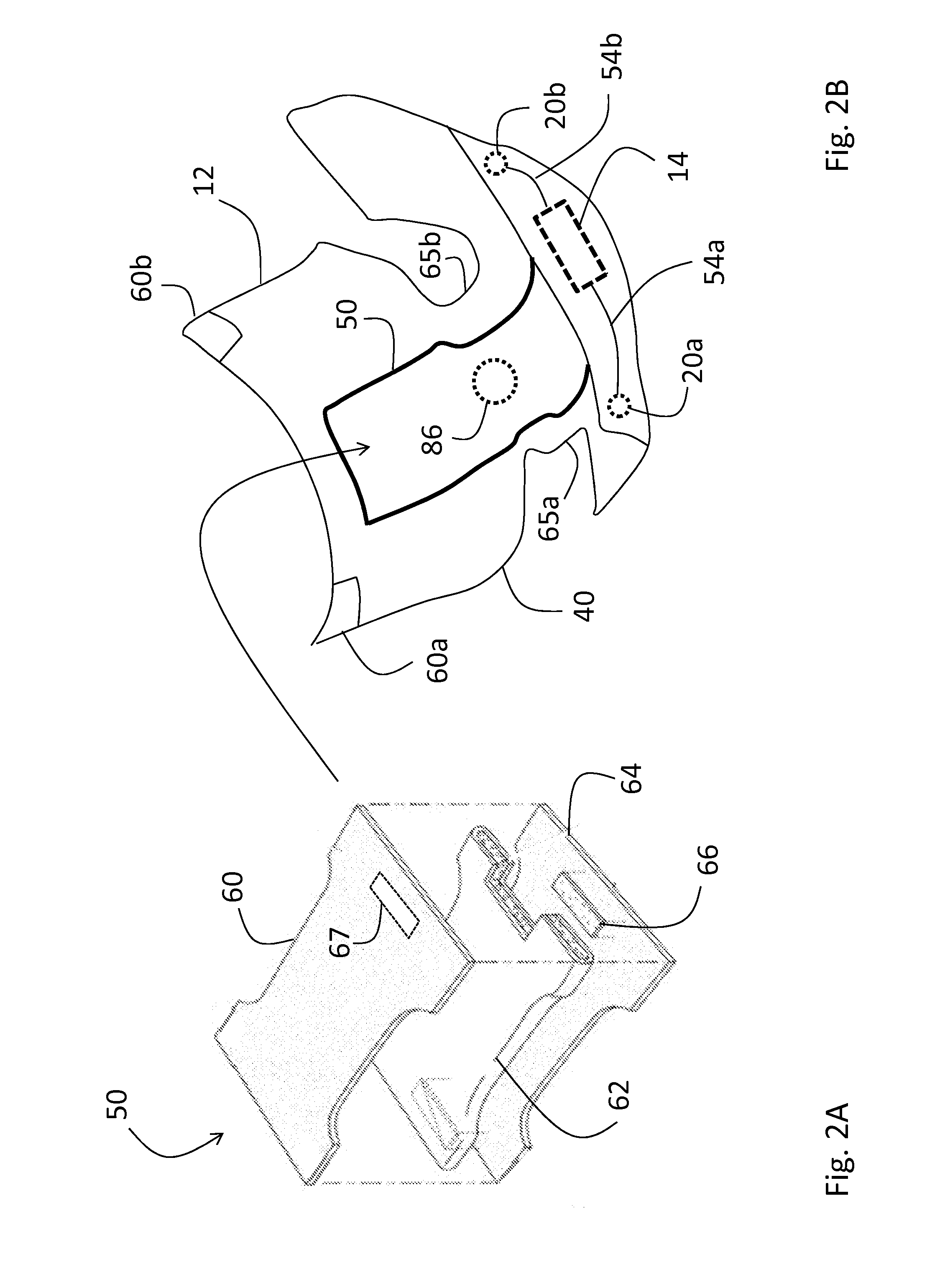 Vital sign monitoring system featuring electronic diaper