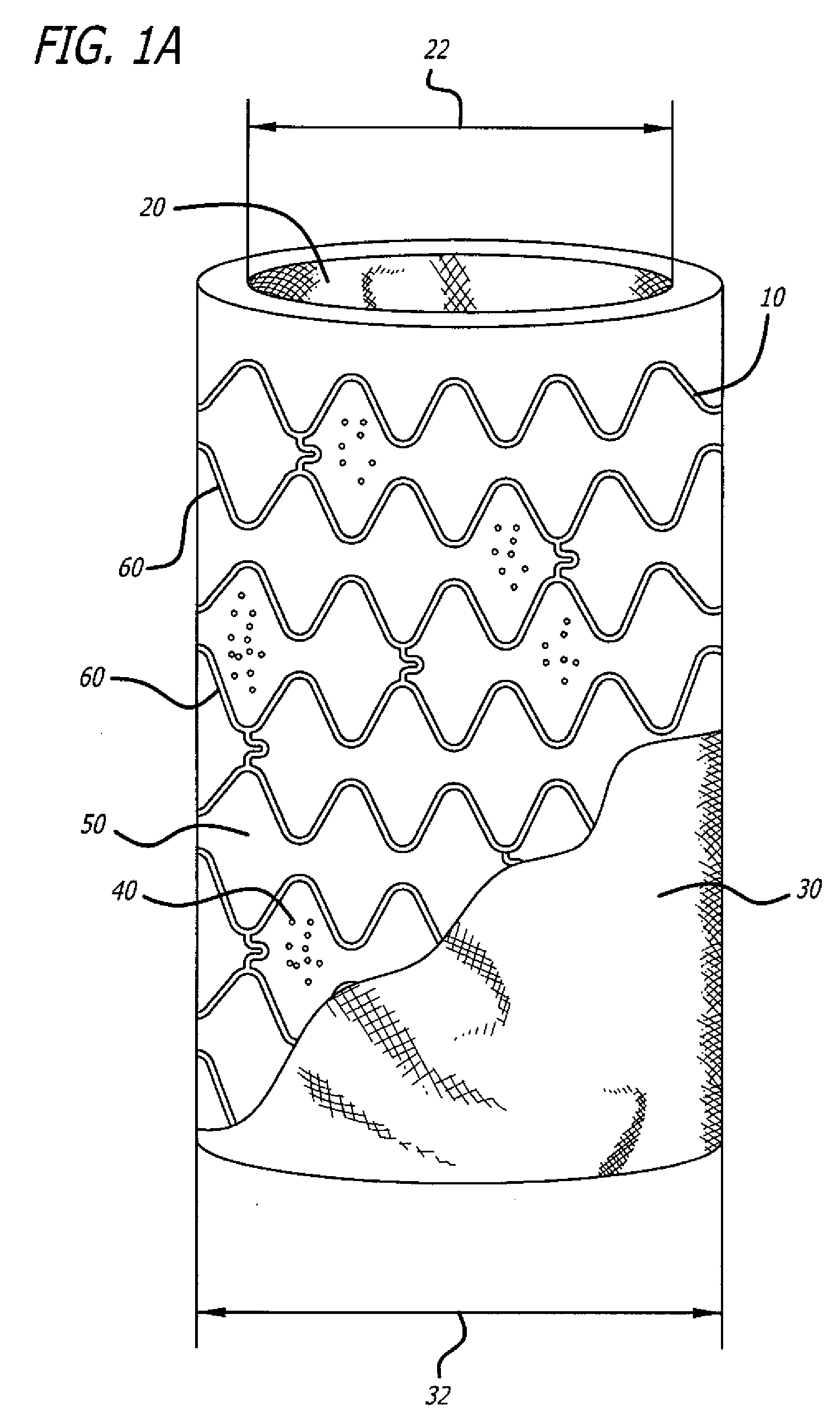 Intravascular Devices for Cell-Based Therapies