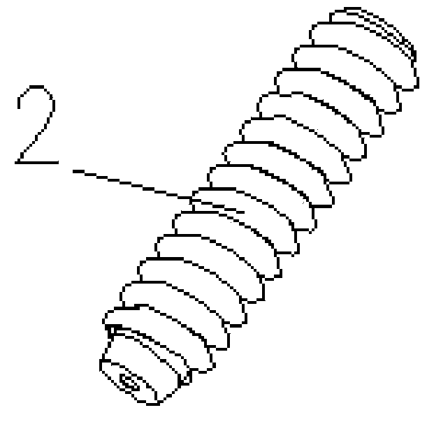 An absorbable mesh reinforced interface screw and its preparation method